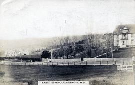 East Whycocomagh